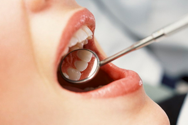 терапевтична стоматологія єврозуб